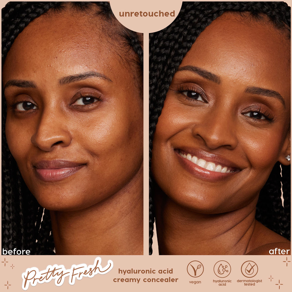 ColourPop Pretty Fresh Creamy Concealer in Dark 175 N blurs under‑eye shadows and evens tone, shown on a smiling model in a split before-and-after, unretouched, with callouts for hyaluronic acid, vegan formula, and dermatologist tested.