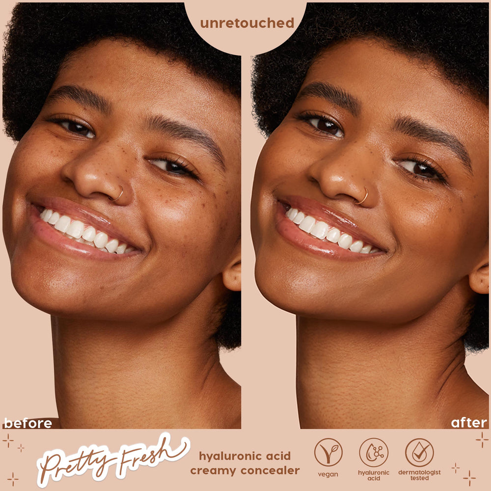ColourPop Pretty Fresh Creamy Concealer in Medium Dark 115 W enhancing a smiling model’s complexion - side-by-side before and after close-up shows smoother, more even coverage; unretouched, hyaluronic acid, vegan, dermatologist tested.